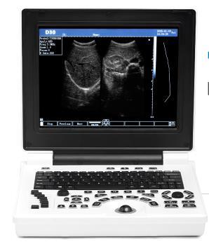 D30 – 12.4” LED Display Portable Ultrasound Machine with Battery Backup